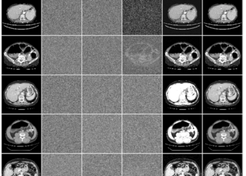 When Optimum is the Enemy of Good: Excessive-Finances Differential Privateness for Medical AI