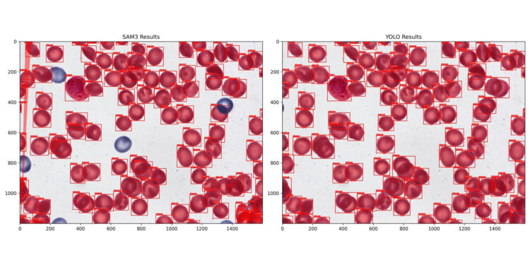 SAM 3 vs. Specialist Fashions — A Efficiency Benchmark